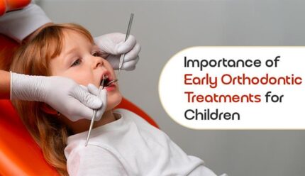 Importance of Early Orthodontic Treatments for Children