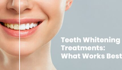 Teeth Whitening Treatments What Works Best